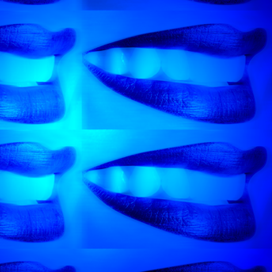 Blue-Roentolografie