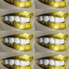 Gold-Lips